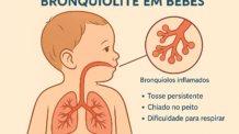 Tudo sobre Bronquiolite em Bebês: Causas, Prevenção e Tratamento